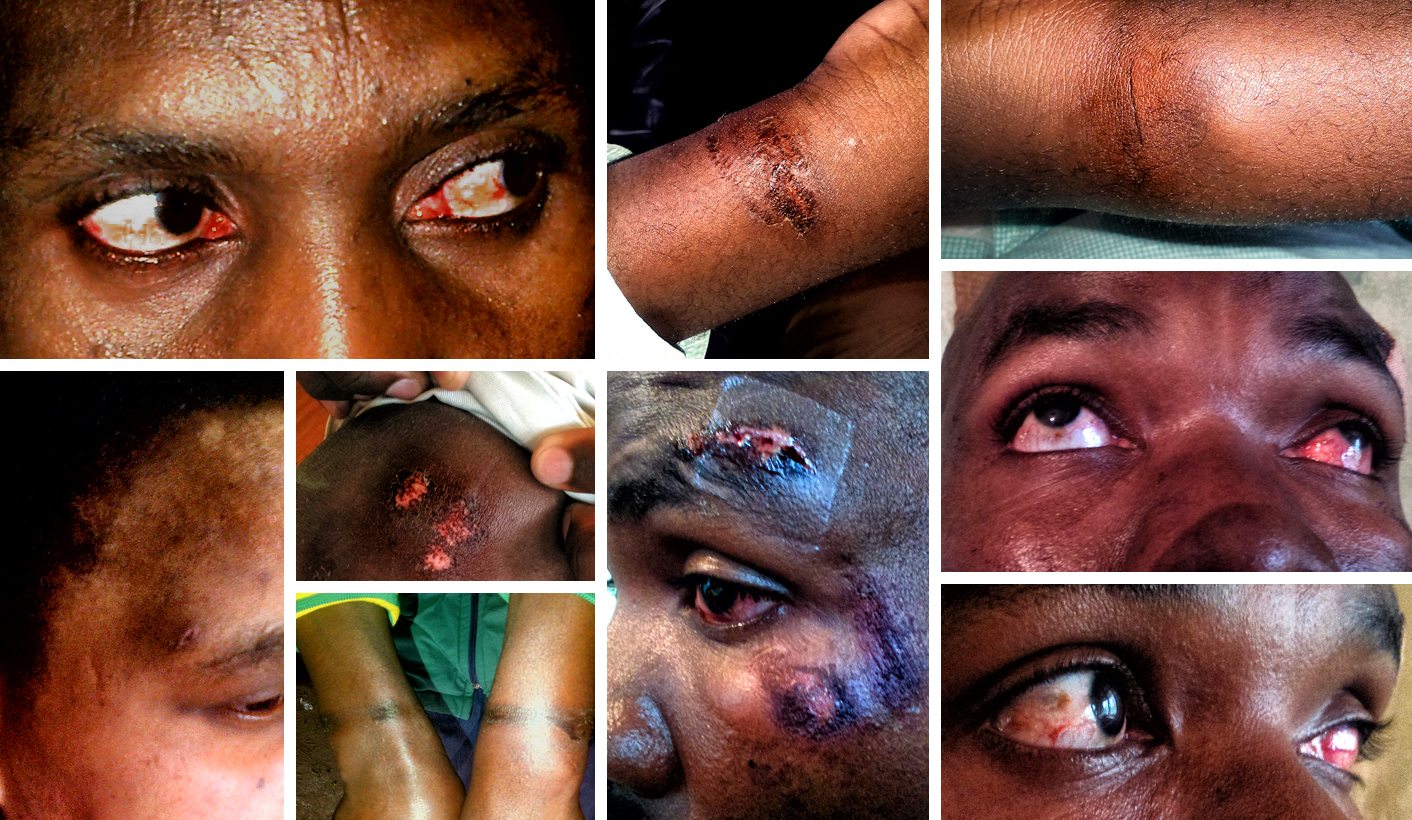 Amabhungane: Torture and the culture of fear in a ‘free’ South Africa