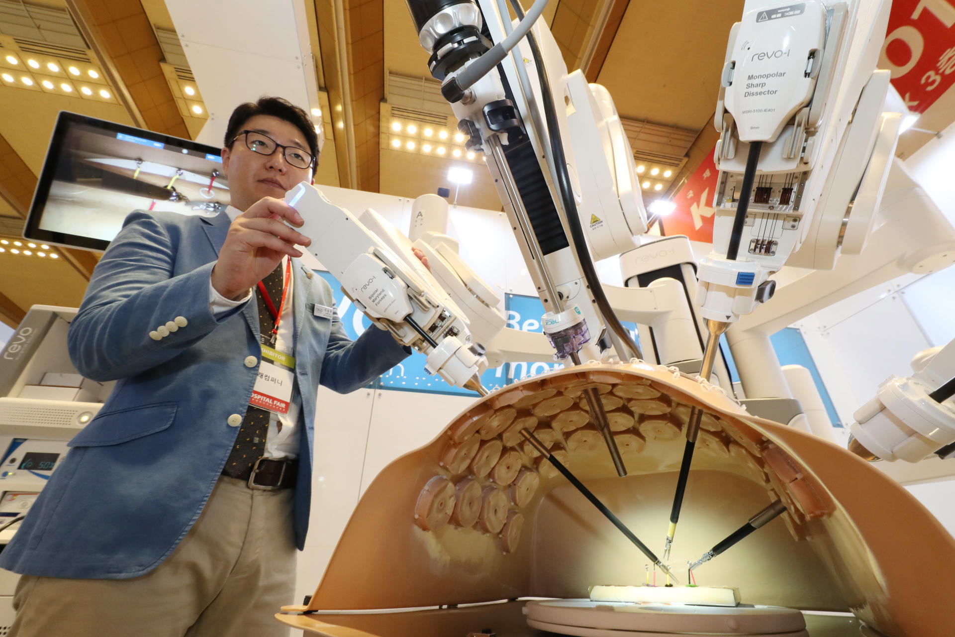 Parkinson's disease may start in appendix, study finds