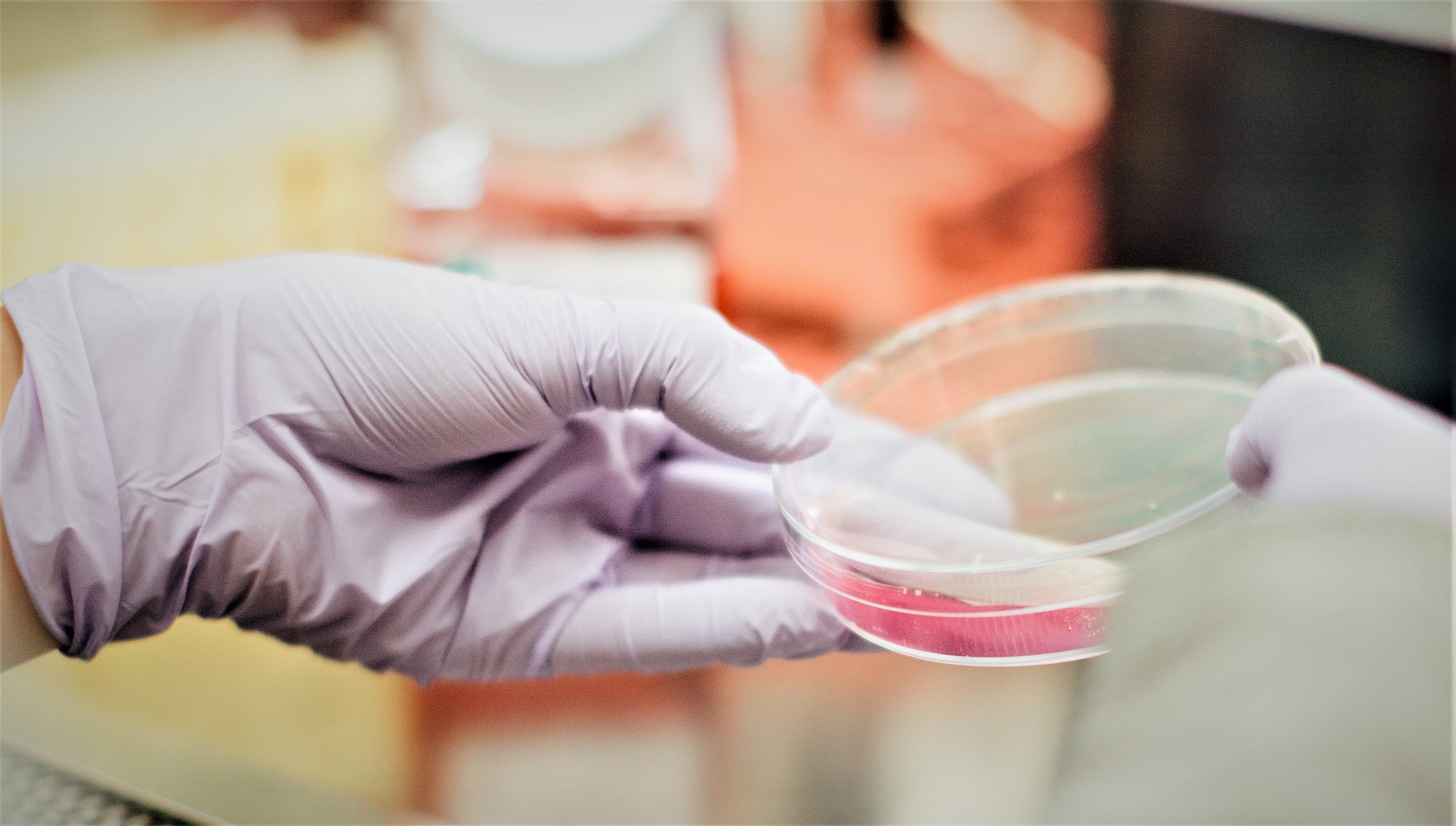 Race determines survival in SA’s cervical cancer patients