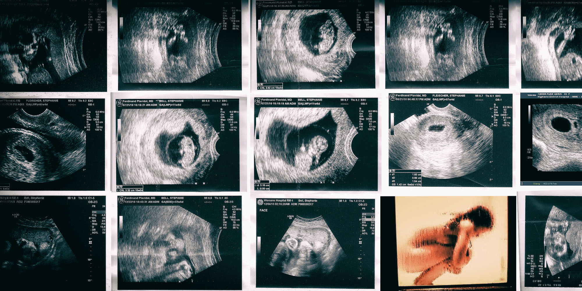 Strong parallels between Alabama abortion vote and reproductive rights in SA and Kenya