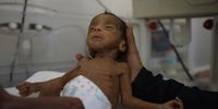 A Yemeni medic checks a malnourished baby inside an incubator at the neonatal intensive care unit of a hospital in Sana'a, Yemen, 2019. (Photo: EPA-EFE / Yahya Arhab)