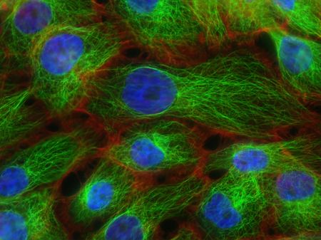 Living with cancer during Covid-19