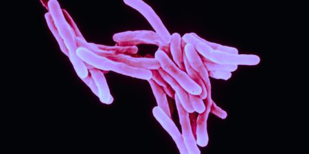 Covid-19: Lockdown takes heavy toll on SA’s TB response