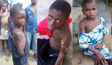 Witch-hunts: The darkness that won't go away