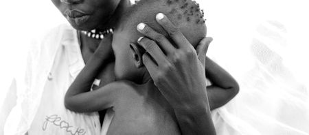 South Africa’s children are too short and too fat, going against the global trend