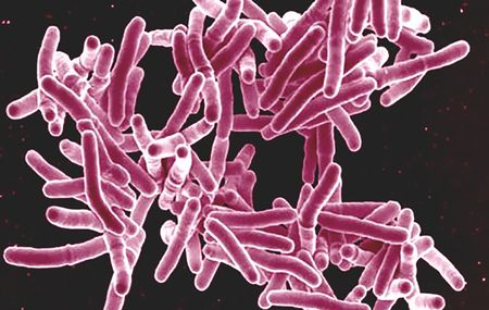 TB vaccine could save tens of thousands of SA lives — but only from 2030