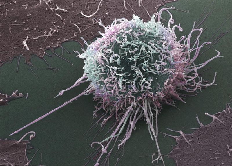 SA scientists decode cancerâs âcloak of invisibilityâ in âmajor leap forwardâ