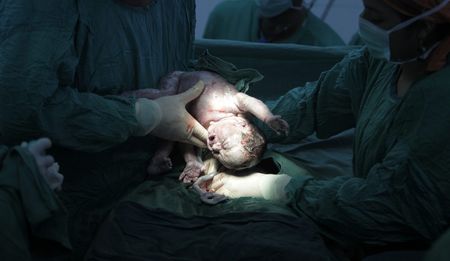 Insufficient evidence to support health claims associated with eating placenta