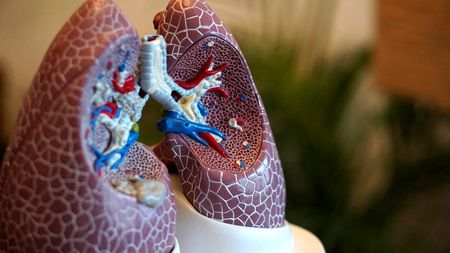‘We were the first to do it’: Innovative SA study takes TB testing to people’s homes