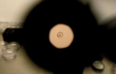 Australian woman gives birth to wrong couple's baby in IVF mix-up