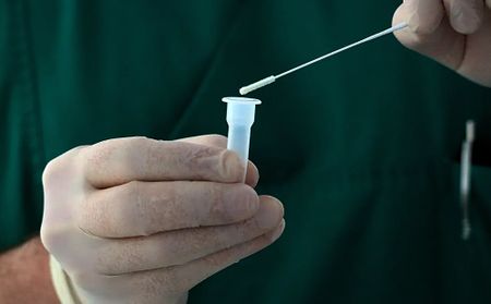 Tongue swabs — where these experimental TB tests might eventually fit in