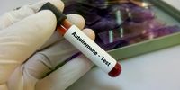 Blood sample for autoimmune disease test and diagnosis of autoimmune disorder. (Photo: iStock)