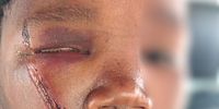 A police officer from Lutzville Police Station in the Western Cape, has been accused of assaulting this 13-year-old boy with a sjambok. <br>(Photo: Supplied)