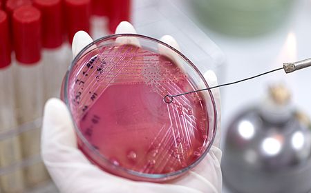 Tackling antimicrobial resistance and the looming threat of mirror life require global action