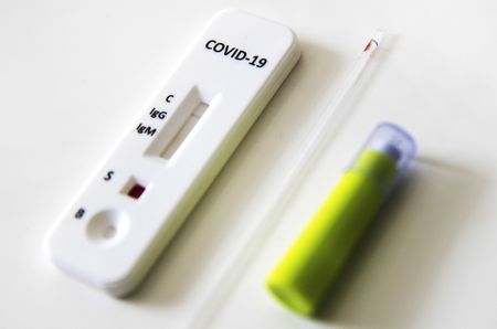 First antibody test gets green light in SA, but use will be limited