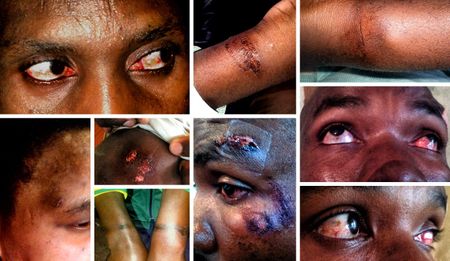 Amabhungane: Torture and the culture of fear in a ‘free’ South Africa
