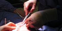 Dr Kairinos, left, stitches the skin and tissue flap into place to cover the bedsore. (Photo: Elsabé Brits)