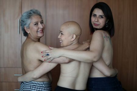 Breast cancer: why it’s difficult to treat and what new approaches are on the horizon