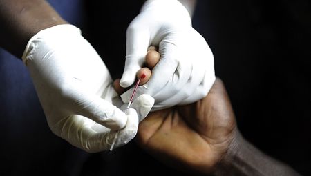 Fingerstick blood test shows promise for TB screening