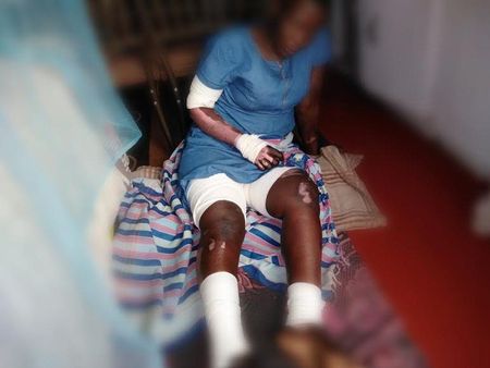 Spar workers who set woman alight have been fired