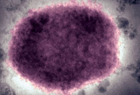 South Africa’s mpox outbreak death toll rises to three, 16 cases confirmed