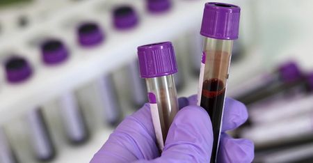 Subclinical TB: Fascinating SA research helps push frontiers of TB science