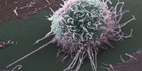 SA scientists decode cancer’s ‘cloak of invisibility’ in ‘major leap forward’