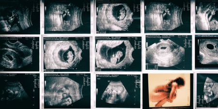 Strong parallels between Alabama abortion vote and reproductive rights in SA and Kenya