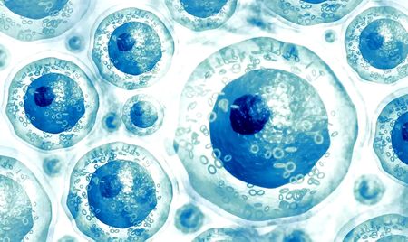 Oldest patient ‘cured’ of HIV after stem cell transplant from donor with rare gene mutation