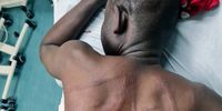 Ugandan man nearly killed by March and March mob speaks from hospital