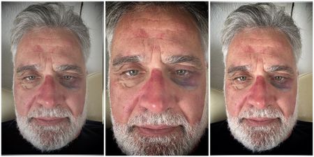 Sars whistleblower Johann van Loggerenberg attacked and robbed while cycling