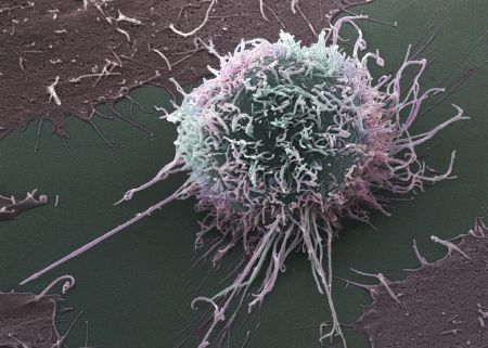 SA scientists decode cancer’s ‘cloak of invisibility’ in ‘major leap forward’