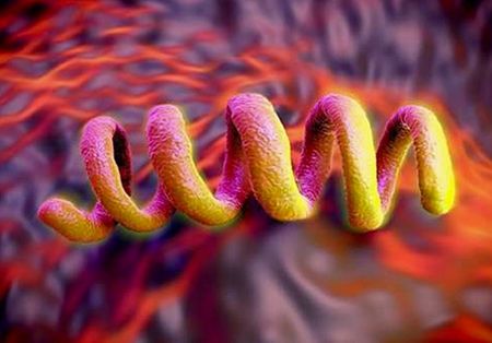 Syphilis rates are spiking around the world — a ‘huge public health failing’