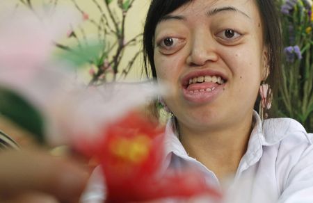 Agent Orange still code red for Vietnamese