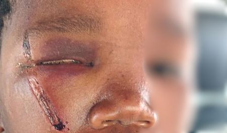 Lutzville police officer out on bail after allegedly assaulting 13-year-old with a sjambok
