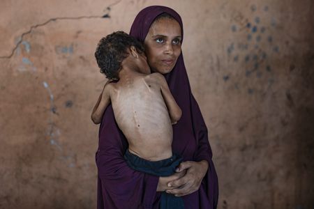 Many of my staff can't work because they are starving, says Gaza City hospital director