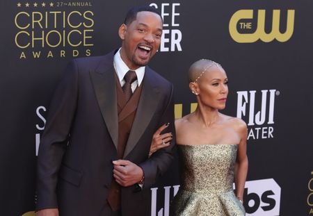 What is alopecia? It’s no laughing matter for millions of Black women