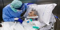 A nurse attends to a COVID-19 patient that is wearing a CPAP helmet while he is moved out of the Intensive Care Unit (ICU) of the Pope John XXIII Hospital on April 7, 2020 in Bergamo, Italy. The number of new COVID-19 cases appears to be decreasing in Italy, including in the province of Bergamo, one of its hardest-hit areas. But as the infection rate slows, life is still far from normal. A local newspaper, the Eco di Bergamo, estimates that the province has lost roughly 4,800 people to coronavirus - almost twice an official tally that only counts hospital deaths - and everyone here knows someone who's fallen ill:  a neighbor, a family member, a relative, a friend or an acquaintance. Since February 23, the day of the first COVID-19 hospitalization, nearly 1,600 people have been hospitalized at Pope John XXIII hospital in Bergamo. Although the situation is improving, the hospital continues to see a high volume of coronavirus patients. On the busiest days during the crisis, its emergency room saw peaks of more than 100 serious coronavirus patients and used up to 146 CPAP helmets to provide non-invasive ventilation. More than 450 additional hospital beds were activated in just a few days, with 92 ICU beds devoted to COVID-19 patients. (Photo by Marco Di Lauro/Getty Images)