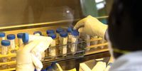A medical staff member checks on sputum samples of patients suffering from TB. (Photo: EPA / Daniel Irungu)