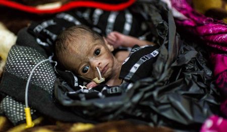 Somalia: The baby in a plastic bag