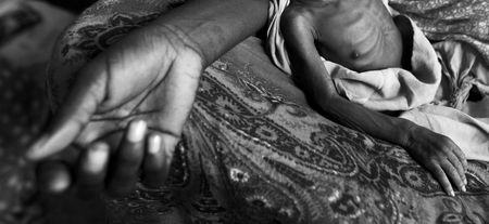 SA’s malnutrition ‘tragedy’ — death of 155 children this year alone sparks calls for urgent state action