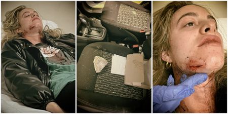 Student latest victim of N2 rock-throwing incident on Cape Town’s 'Hell Run'