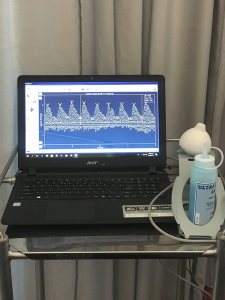 South Africa’s low-cost doppler ultrasound is reducing stillbirths and improving primary health care services