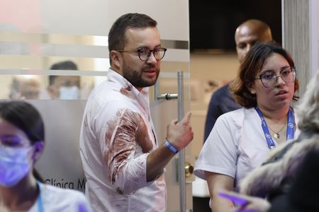 Surgery on Colombian senator Uribe went well after shooting, wife says