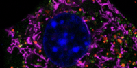 Cell undergoing autophagy (green organelles) – the magenta structures is the place where it all happens, metabolites generate energy (ATP). Image: Supplied by Professor 