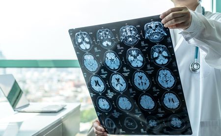 Required internships with no pay put prospective neuropsychologists ‘between a rock and a hard place’