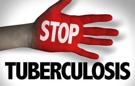 Tackling TB: A new trial is asking how to take tuberculosis tests to the people