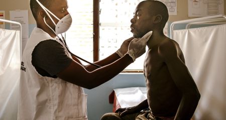 Why so many people still die from Aids-related illnesses despite more people being on treatment