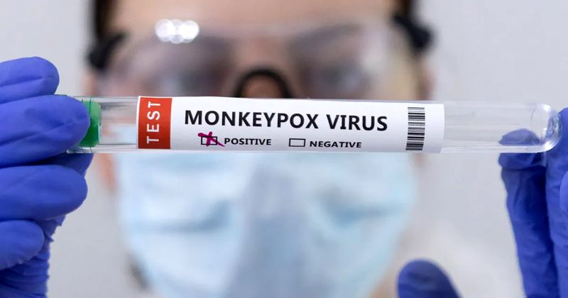 South Africa confirms first case of monkeypox