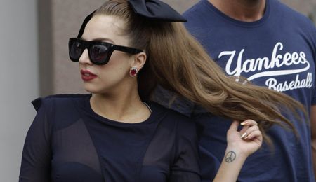 Lady Gaga Has Hip Surgery, Calls Injury 'Bump In The Road'